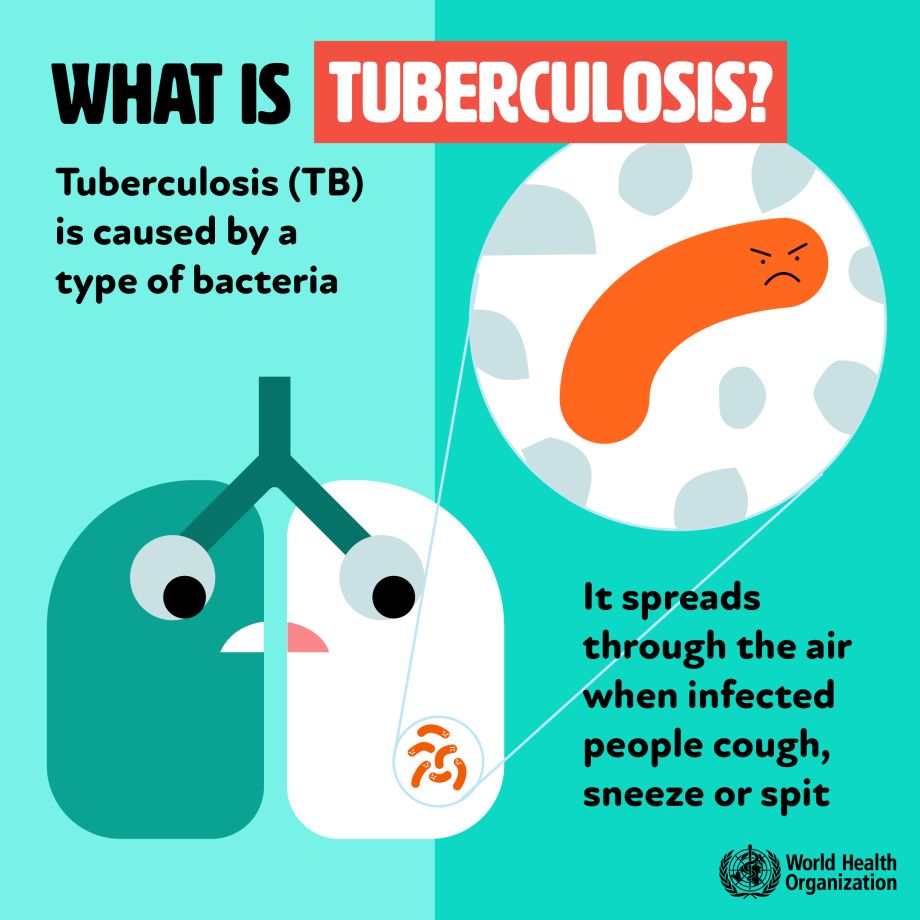 Lebih Mengenal TB Dalam Rangka Hari Tuberkulosis Sedunia (HTBS) 2024