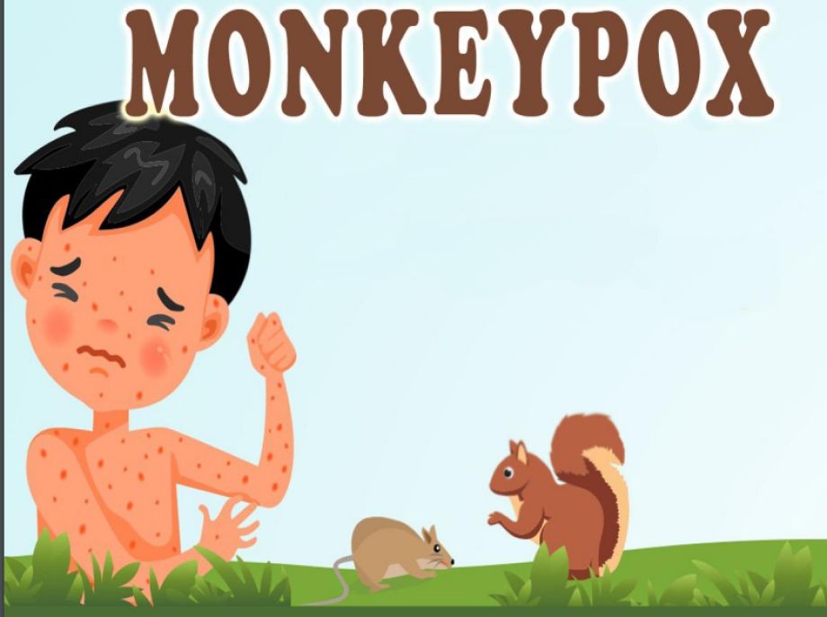 Kenali MonkeyPox (MPOX)